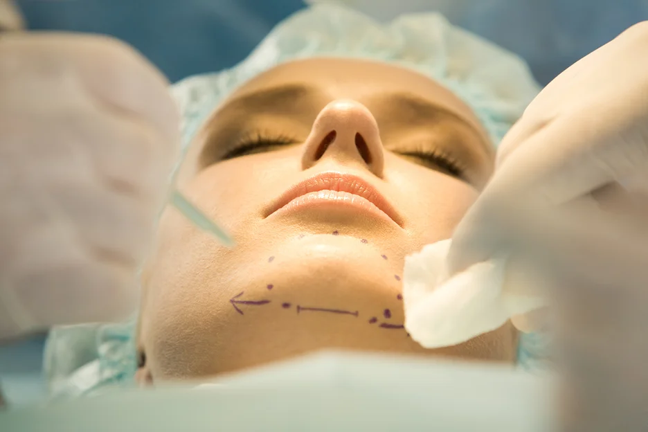 chin surgery