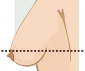 A diagram showing the size of a woman's breast.
