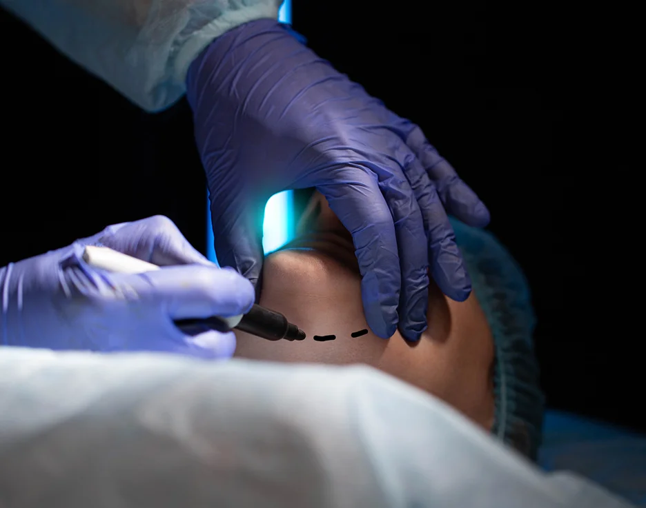A woman undergoes a chin lipo procedure to enhance her facial appearance.