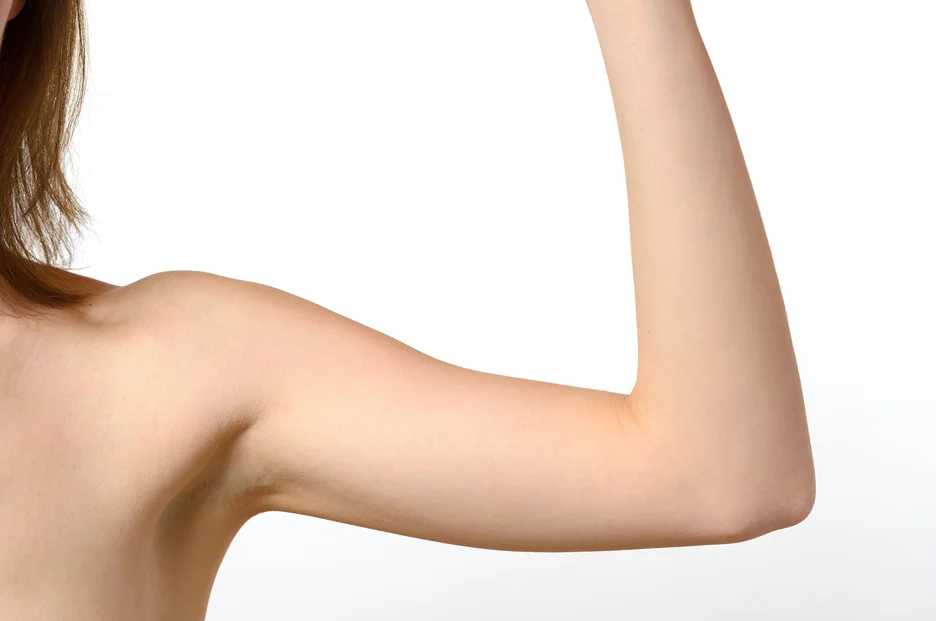 A woman displaying her arm
