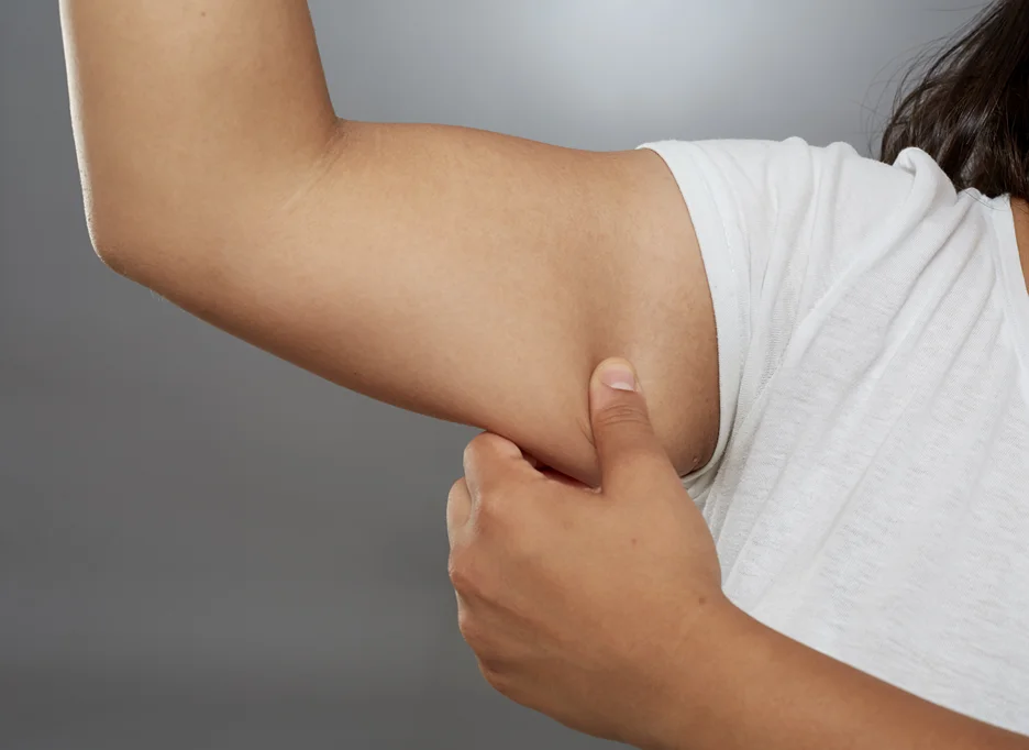 A woman pinching her fat arm
