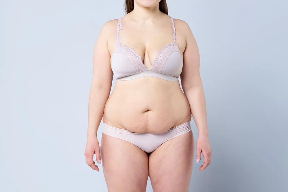 An Ideal Candidate for Mommy Makeover