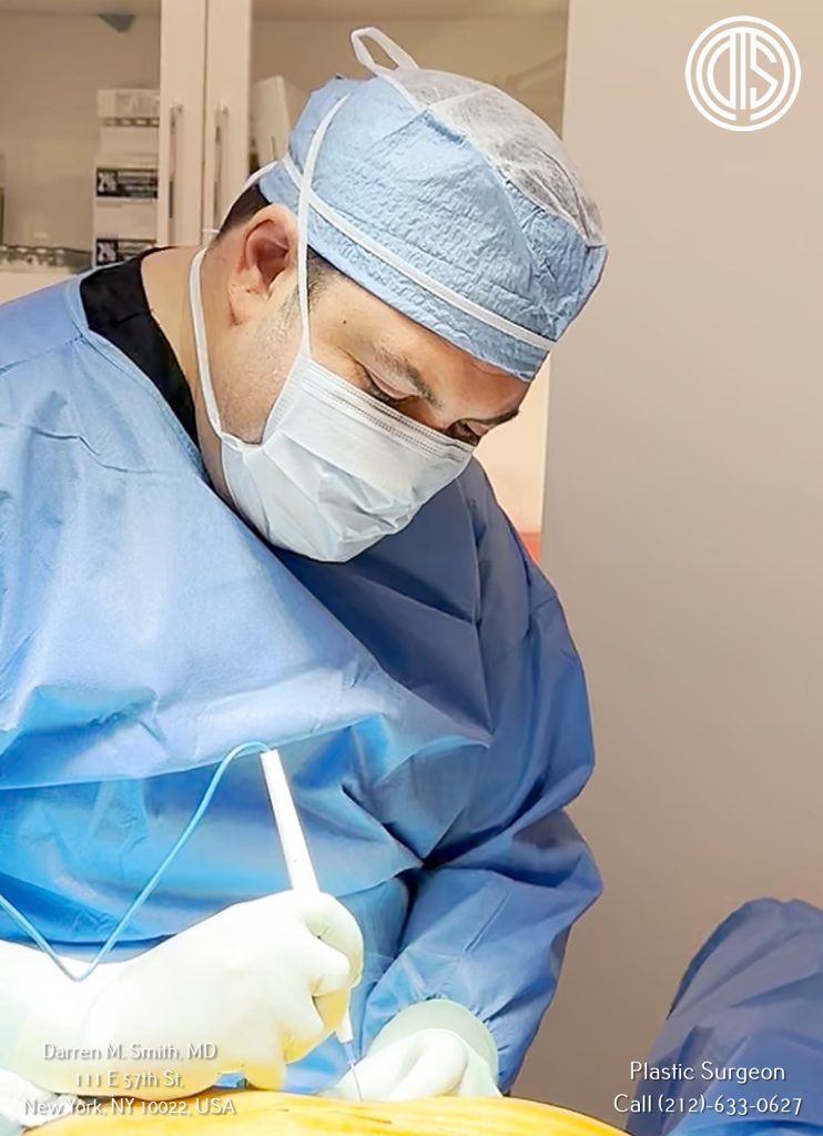 Mommy Makeover Procedure at Dr. Darren M. Smith, MD